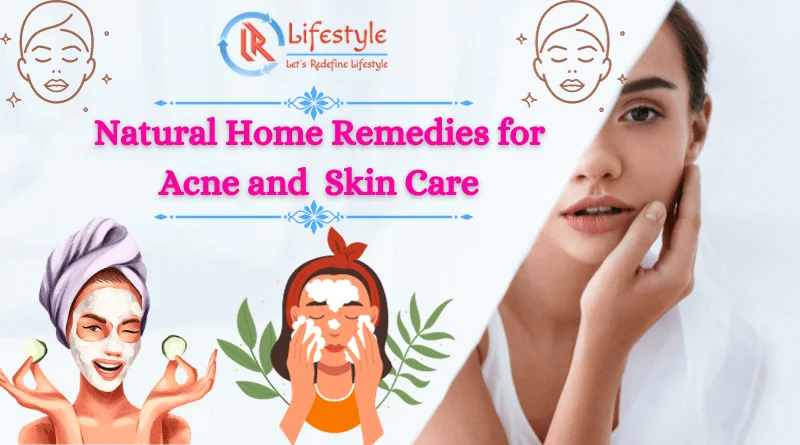 Natural Home Remedies for Acne and Skin Care Article by Let's Redefine Lifestyle